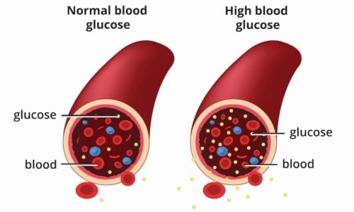 Glucose