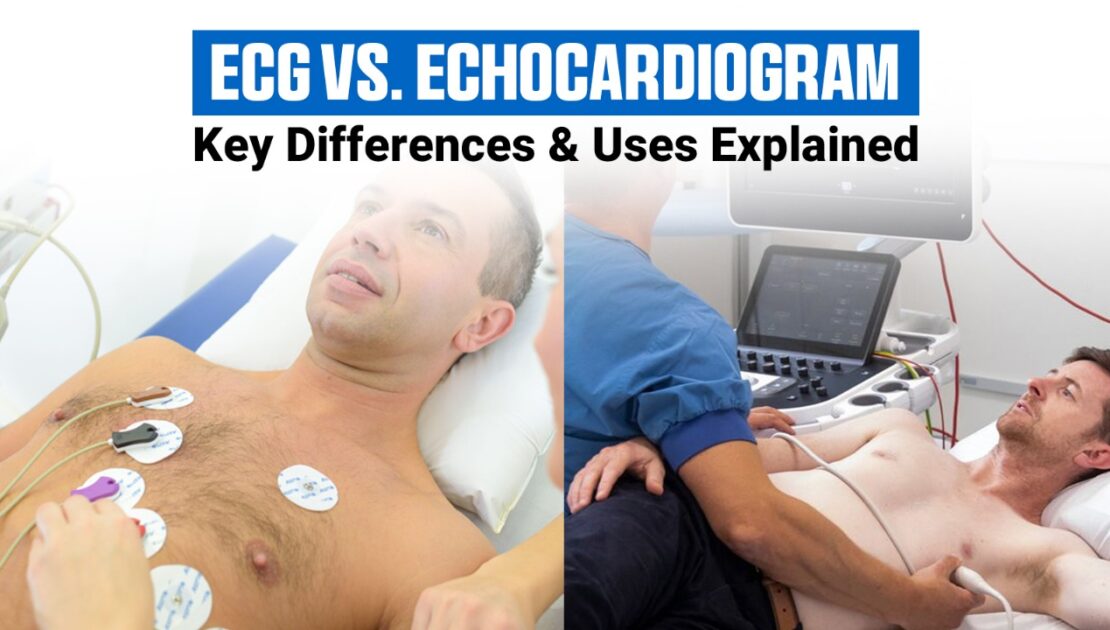 ECG (Electrocardiogram)