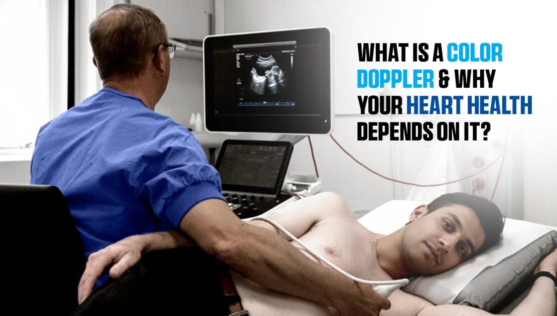 What Is a Color Doppler and Why Your Heart Health Depends on It?